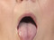 Wolli