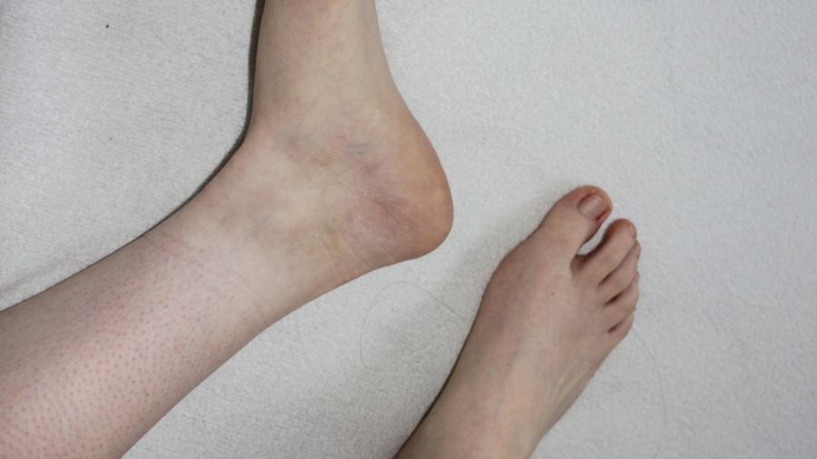 Image of Meine Füße und meine Achseln