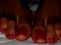 Red toenails