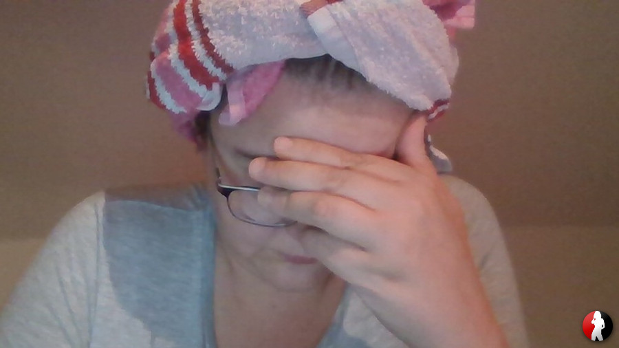 Narben sind auchschön