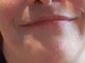 Der Vitaminf**k