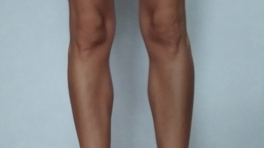 Sexy legs!