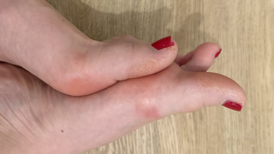 Rot lackierte Füße