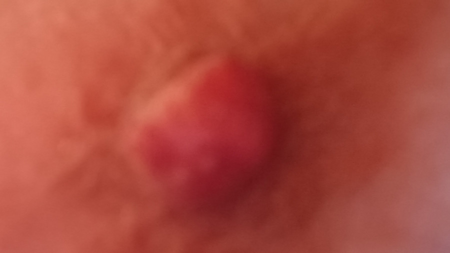 Mein Nippel ist richtig geil und prall! Willst du mitspielen?