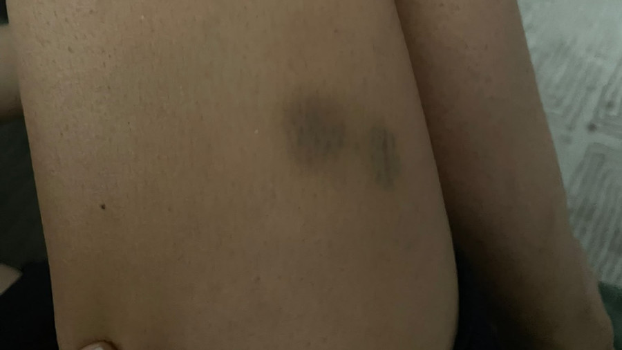 Wieder so ein d***kiger Sex-Abdruck, super
