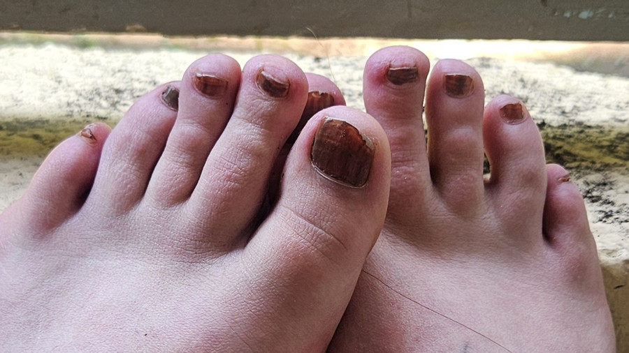 Sommer Füße / Summer Feet