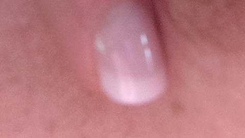 Privat mit und ohne Sahne