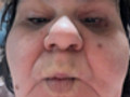 Normale Bilder